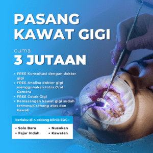 Promo Pasang Kawat Gigi