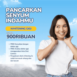 Promo Painless Teeth Whitening